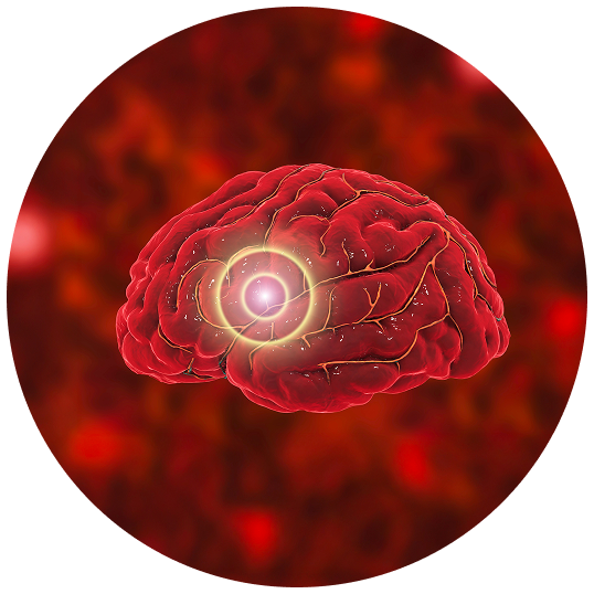 Brain with a target